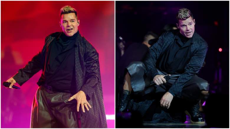 ricky martin cosmetic surgery