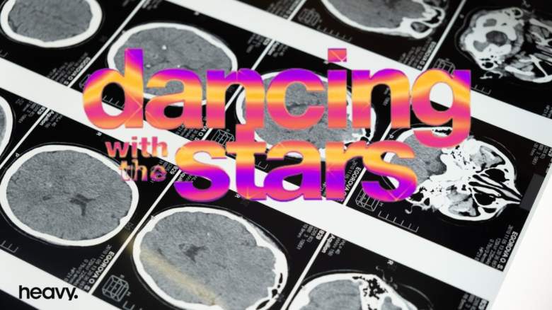 DWTS Brain Scan