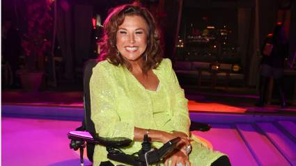 Abby Lee Miller Raves About ‘Amazing’ New Cosmetic Procedure